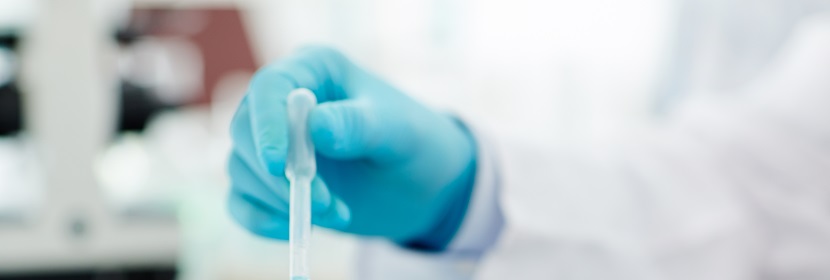 環(huán)氧乙烯基酯樹脂檢測(cè)